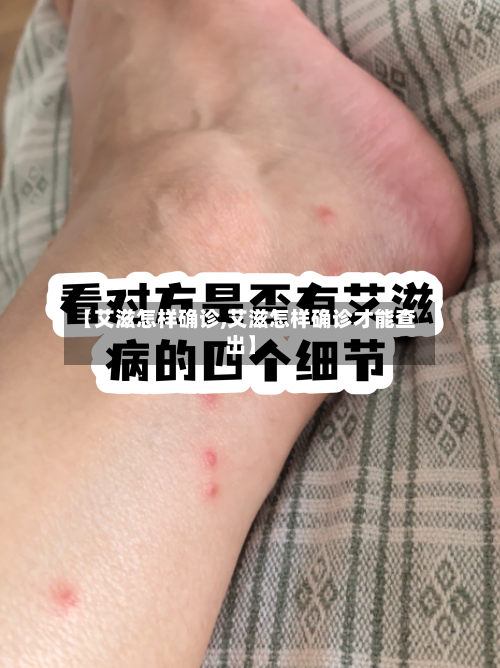 【艾滋怎样确诊,艾滋怎样确诊才能查出】