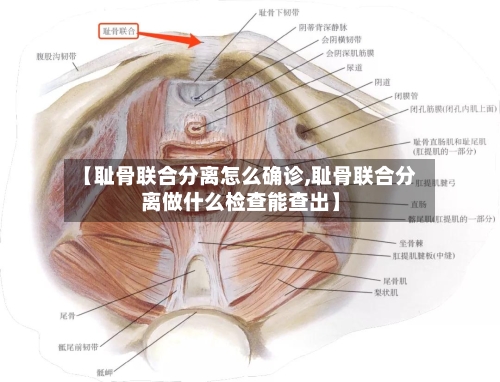 【耻骨联合分离怎么确诊,耻骨联合分离做什么检查能查出】