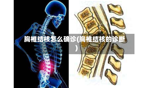 胸椎结核怎么确诊(胸椎结核的诊断)