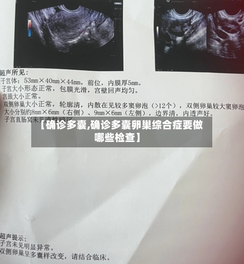 【确诊多囊,确诊多囊卵巢综合症要做哪些检查】-第2张图片