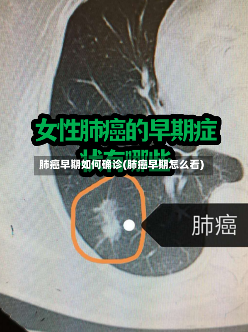肺癌早期如何确诊(肺癌早期怎么看)