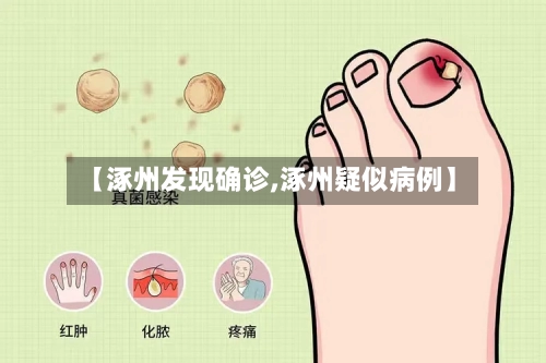 【涿州发现确诊,涿州疑似病例】-第3张图片