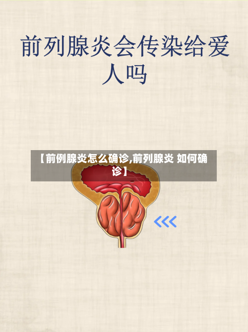 【前例腺炎怎么确诊,前列腺炎 如何确诊】