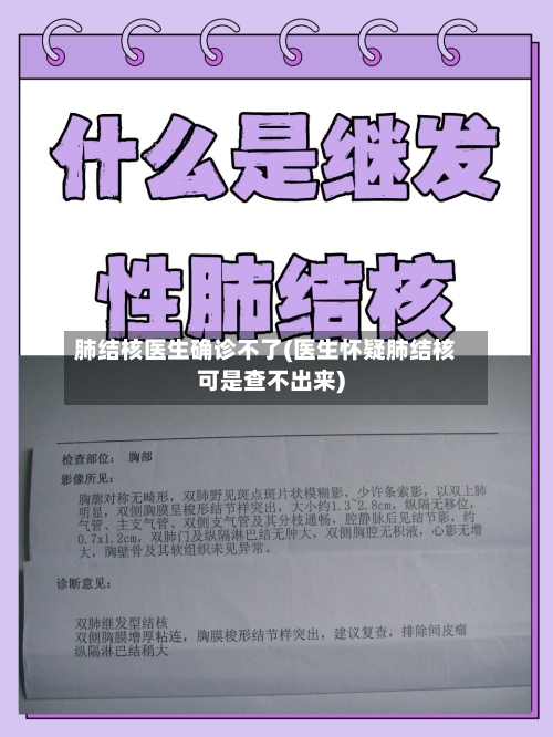 肺结核医生确诊不了(医生怀疑肺结核可是查不出来)-第2张图片