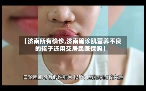 【济南所有确诊,济南确诊肌营养不良的孩子还用交居民医保吗】